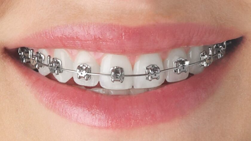 orthodontics